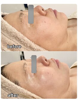 サロン ド ベル(salon.de.Belle)/陶肌トリートメント