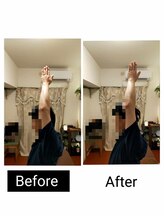 アース エンジェル整体院/ビフォアフ　肩こり　ストレッチ