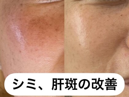 リノアンド(Lino&)の写真