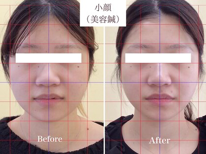 ライフサロン 天神(Life Salon)の写真