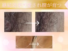 ミドリハッピーチャージサロン 赤坂 乃木坂の雰囲気（一度の変化でこちら。集中徹底ケアは本気の方必須です！）