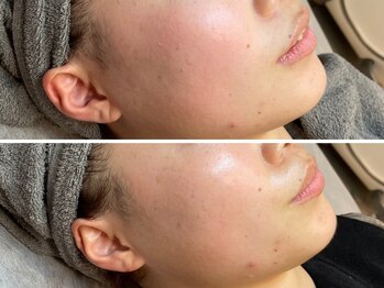 モーヴサロンエトフルール(mauve salon.et.fleurs)/ラミネーションピール・施術