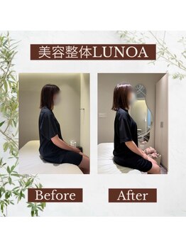 ルノア 渋谷院(LUNOA)/定期的なケアで根本改善