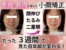 アンリエッタ(Unlieta)