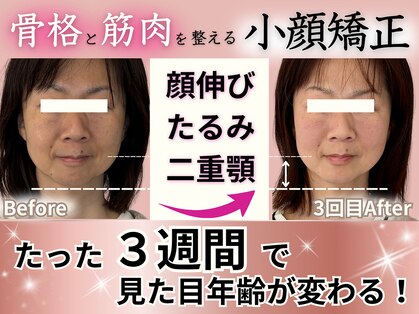 アンリエッタ(Unlieta)の写真