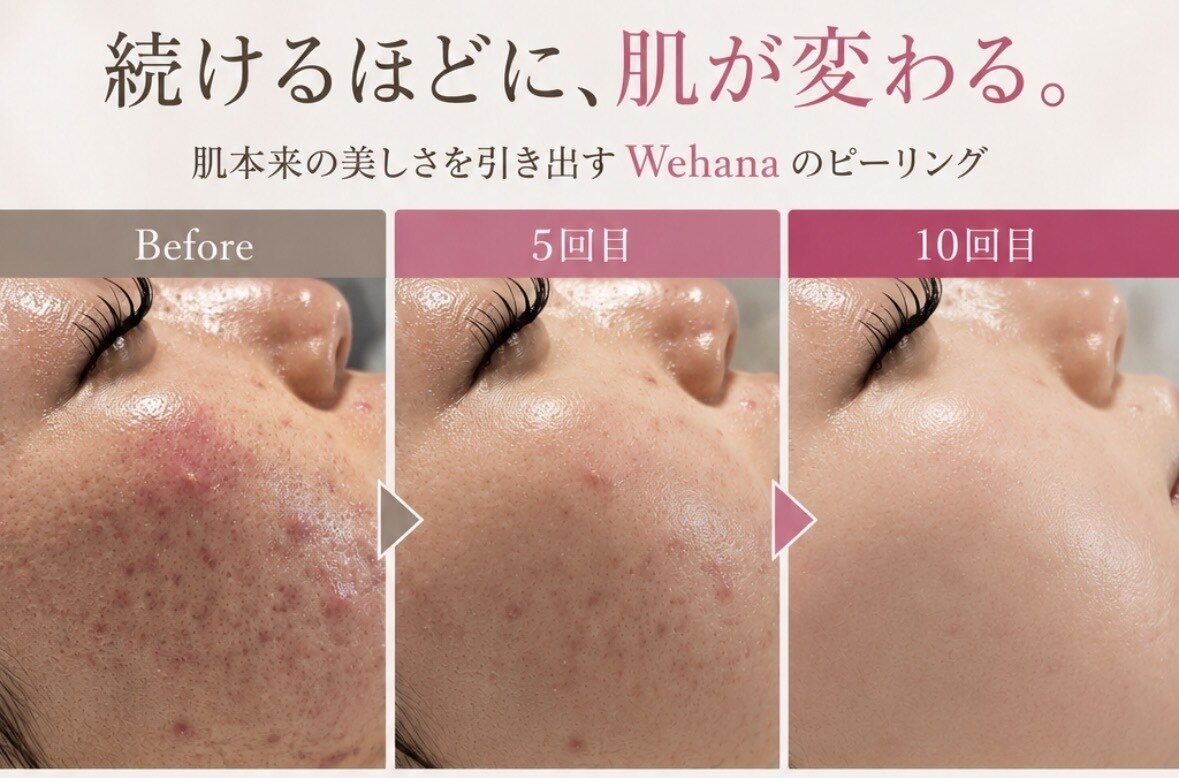 ウィハナ(wehana)｜ホットペッパービューティー