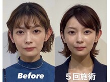 コルミチョン サロン(骨美整 salon)
