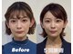 コルミチョン サロン(骨美整 salon)の写真