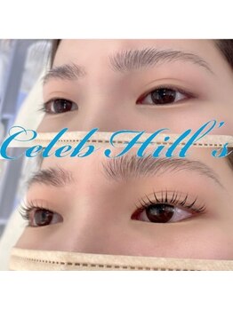 セレブヒルズ 大通店(Celeb Hill's)/