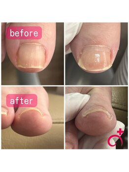 Dr.巻き爪 天神院/