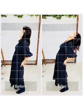 門前仲町イエティ鍼灸整骨院（旧：イエティ鍼灸整骨院）/ビフォーアフター♪