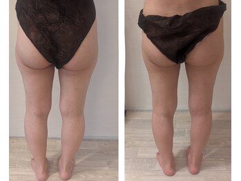 ムーンブロッサム(MoonBlossom)/上半身or下半身90分