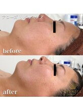 トータルエステティック ビューティスト 足利店(Total Easthetic Beautist)/アローズリバースケア