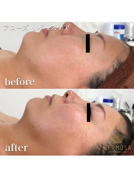 トータルエステティック ビューティスト 足利店(Total Easthetic Beautist)/アローズリバースケア