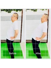 門前仲町イエティ鍼灸整骨院（旧：イエティ鍼灸整骨院）/ビフォーアフター♪