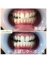 ルブラン 奈良店(Le Blanc)/効果の凄さ！！