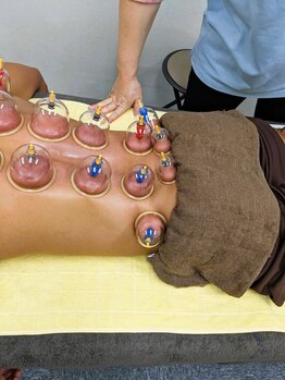 一期一縁 愛媛松山店/吸玉 肩・背中・腰に別角度