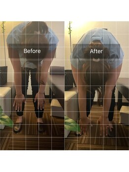 たんぽぽ整骨院鍼灸院/ストレッチ指導による改善♪