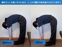 鈴家/猫背ビフォーアフター/肩こり