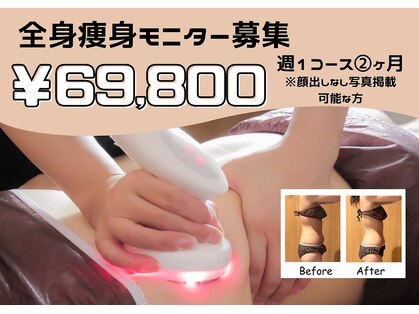 ミルキー(MiLuKy)の写真