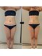 ミル(miru)の写真/【インディバ専門/歴13年】結果を求める女性の為の痩身インディバでサイズダウン×ボディラインを引締め!!