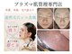 エスボーテ(sbeaute)の写真