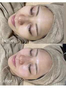 ミーミドットアイ(Mi-mi.i)/艶肌+磁気パックでお肌を活性化