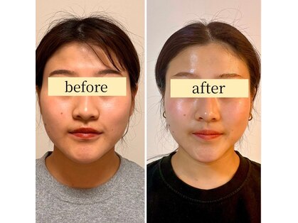 ノアール(Noahr)の写真