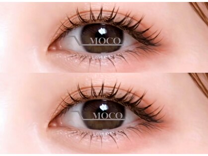 モコ(MOCO)の写真