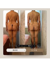 トータルサロン ヴィータ(VITA.)/ポールシェリー痩身