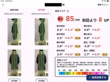 ベリー(Berry)/姿勢矯正の結果