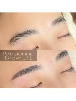 スカイ(Sky)/美眉毛ブロウリフト