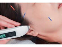 美容鍼灸salonまつもと/