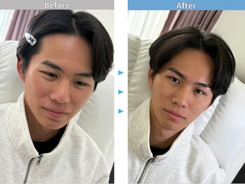 マユクリア 埼玉大宮店/美眉B/A [眉毛/眉毛サロン/大宮]