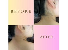 ルナソルビューティーサロン 浜松店(Lunasol)/大人気♪うなじ MIX脱毛