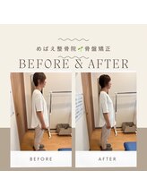 めばえ整骨院/お客様のbefore　after