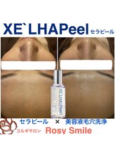 ロージースマイル(Rosy smile)/【韓国肌管理★　セラピール　】