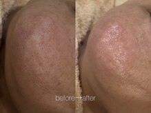 リコ ヘアアンドリラクゼーション(LICO)/フェイスワックス