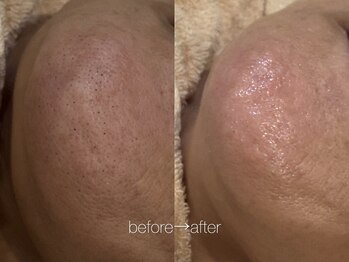 リコ ヘアアンドリラクゼーション(LICO)/フェイスワックス