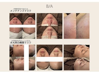 ポピン(POPIN)/volayonのプレミアムマスク☆