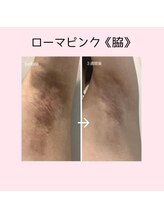 ファースト(1st)/