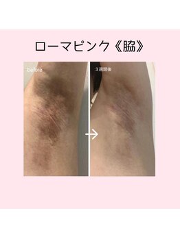 ファースト(1st)/