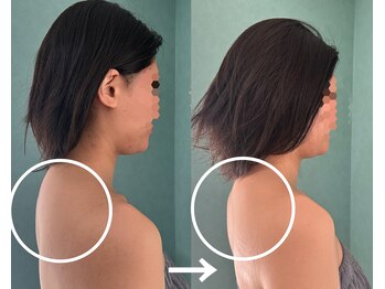 ルーチェ(LUCE)/筋膜リリース/骨盤矯正/美容整体