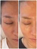 ＼人気No．2／美容のプロも注目する肌改善|くすみ／ほうれい／しわたるみケア