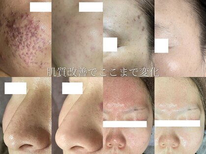 ラヴィアンローズ 泉店 (La vie en Rose)の写真