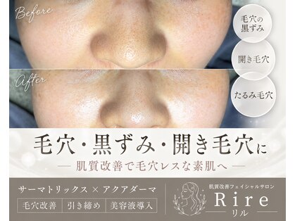 リル(Rire)の写真