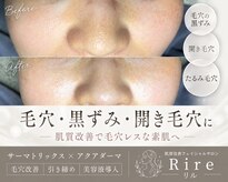 リル(Rire)