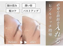 トロワ(TROIS)の雰囲気(定期ケアでキレイをキープ♪5年後のたるみ予防へ!長野市/小顔)