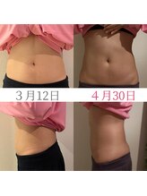 モモ 三ノ宮店(momo)/痩身効果絶大☆すっきりBodyへ☆