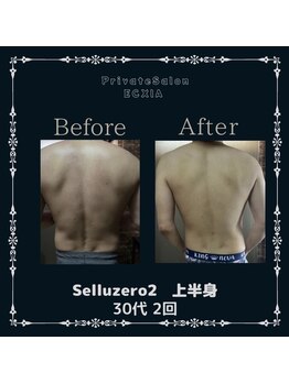 エクシア(ECXIA)/痩身エステ